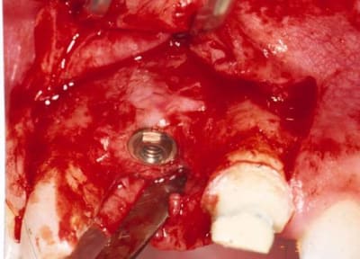 Amant4 gknrni - Eugenol