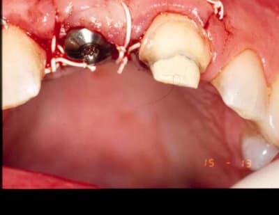 Amant5 czqisp - Eugenol