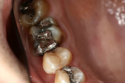 Amaris2 w8xzpf - Eugenol