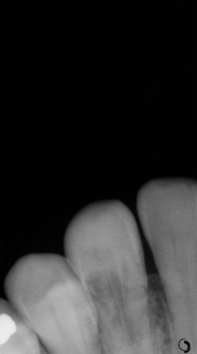 Ang teaamv - Eugenol