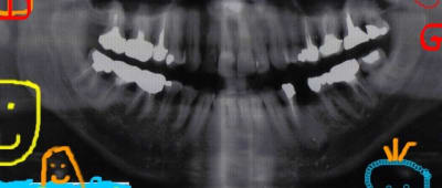 Annie pano mjfoax - Eugenol