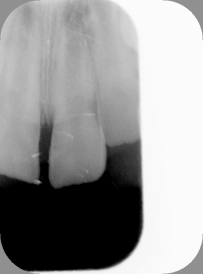 Apr s awkifl - Eugenol