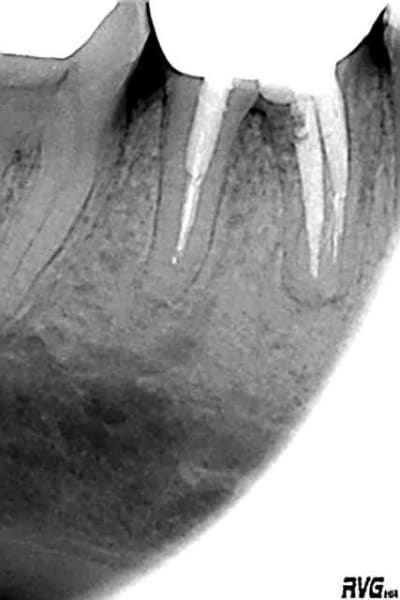 Apres 25022005 blbnb9 - Eugenol