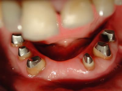 Apres 2 rilwxg - Eugenol