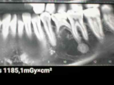 Apzg85kz9p6y3ljxd6hz - Eugenol