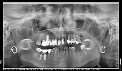 Arqisve365sqsnygej3ryckjm2a3 - Eugenol