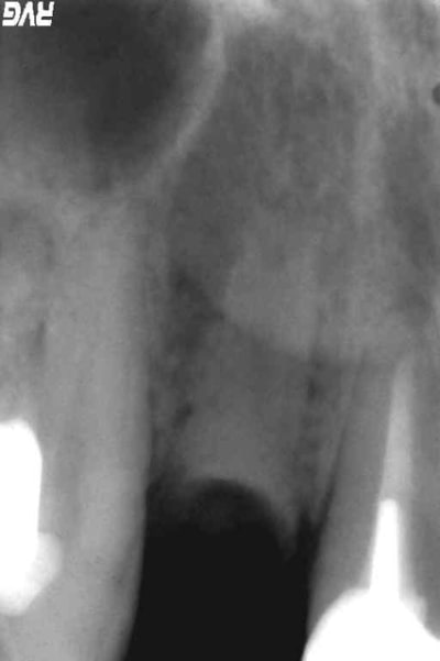 Augmentat q2wihy - Eugenol