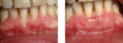 Av ap 15j olw2d7 - Eugenol