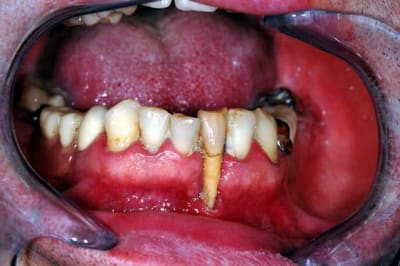 Avant01 zxfdtx - Eugenol