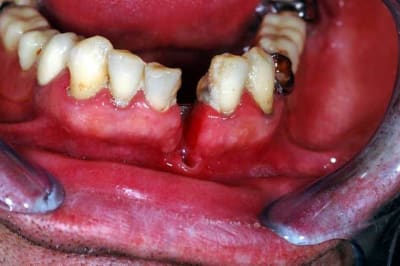 Avant02 zjkmrg - Eugenol