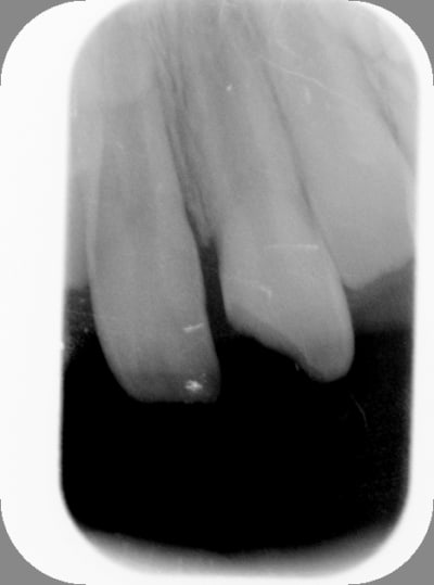 Avant v6xc9e - Eugenol