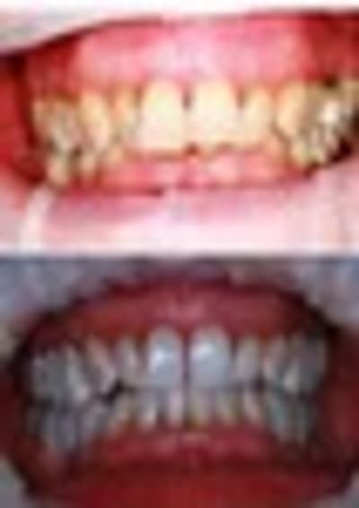 Avap1 thumb lbcz5o - Eugenol
