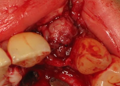 Avl gsning iz6lsc - Eugenol