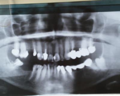 Aya11 efkewa - Eugenol