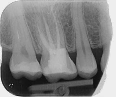 Aygsiciupsglghnpzbws - Eugenol