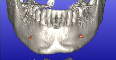 Baron audrey aper u4 yv5ebl - Eugenol