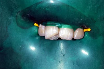 Baseemail sfweis - Eugenol