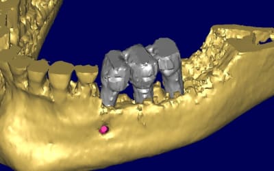 Bernard 3d3 kd3ilv - Eugenol