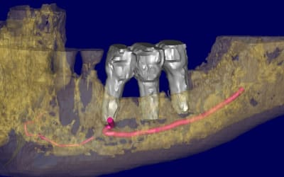 Bernard 3d st3fpe - Eugenol