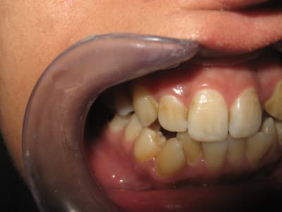 Bilan orthodontie hanguag sihm 007 mhcm6z - Eugenol