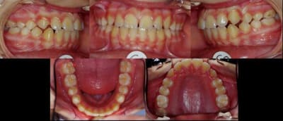 Bipro fin endo so6kk6 - Eugenol