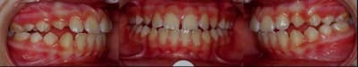 Bipro pendant ttt t7rrqw - Eugenol