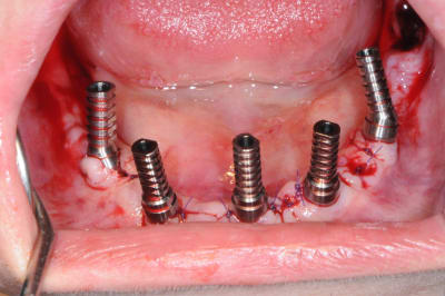 Bjtttkkchemfus94f8me - Eugenol