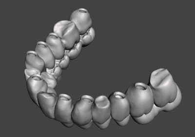 Bridge aw2gyb - Eugenol