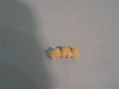 Bridge temp 3 ps5kyh - Eugenol