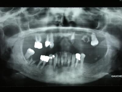 Brigitte1 rdq5gj - Eugenol