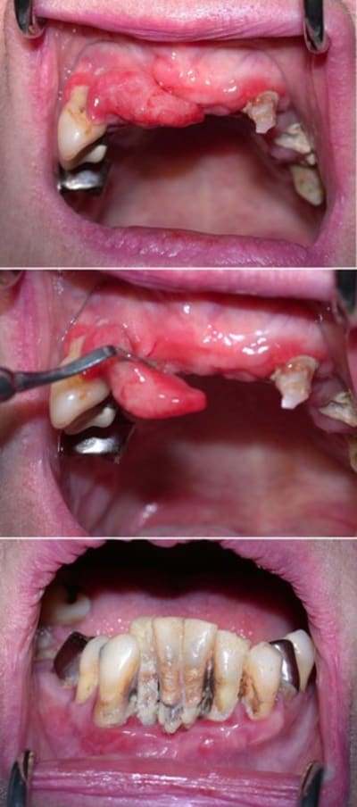 Brigitte2 gi0fte - Eugenol