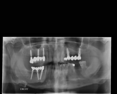 Brma tooh7q - Eugenol