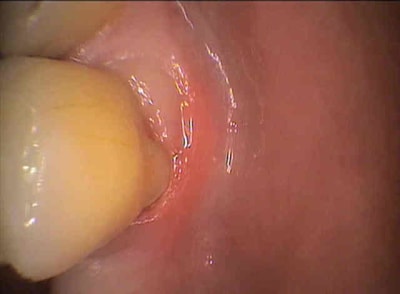 Brune ffuygj - Eugenol