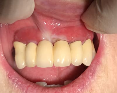 Bytktd4laqthypeovvqg - Eugenol