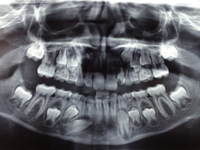 Canincluse uhzxsd - Eugenol