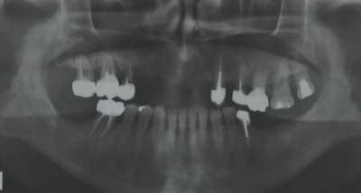 Cas01 jcq2ed - Eugenol