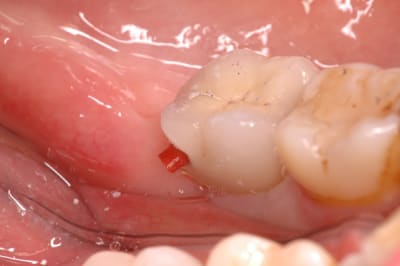 Cas 4 5 hhnuag - Eugenol