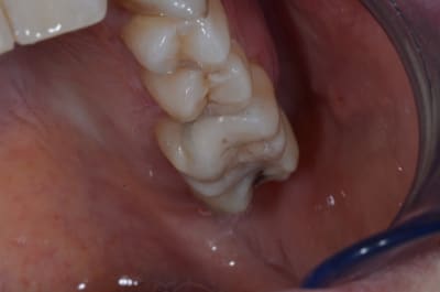 Castellan 006 o7jxa4 - Eugenol