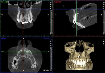 Cbct2 vwykyh - Eugenol