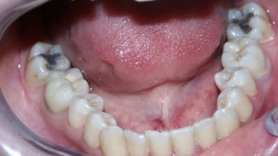 Ccm36et46 tl1n3b - Eugenol