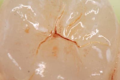 Ccm face occ2 nvfzxu - Eugenol