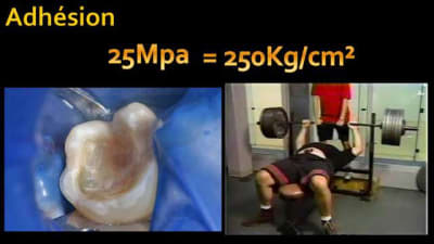 Ceramique part1 xu4hvn - Eugenol