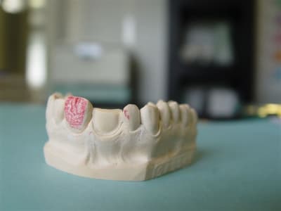 Cerec13 uxf4ru - Eugenol