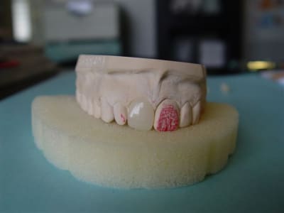 Cerec16 ew1if5 - Eugenol