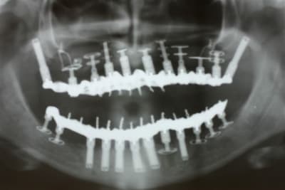 Cestmoiua mnq8yq - Eugenol