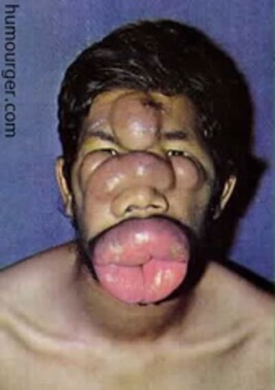 Chetron itpsco - Eugenol