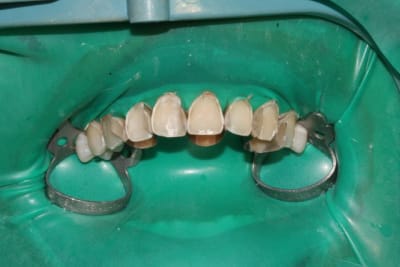 Collage1 ddats8 - Eugenol