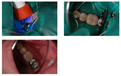 Collage page001 slsf5n - Eugenol