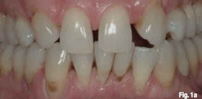 Compo avant ox4j4e - Eugenol