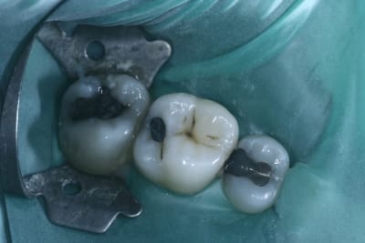 Compos 001 ydx7lj - Eugenol